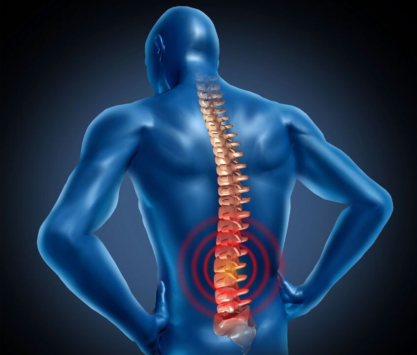 Osteocondosi lombale